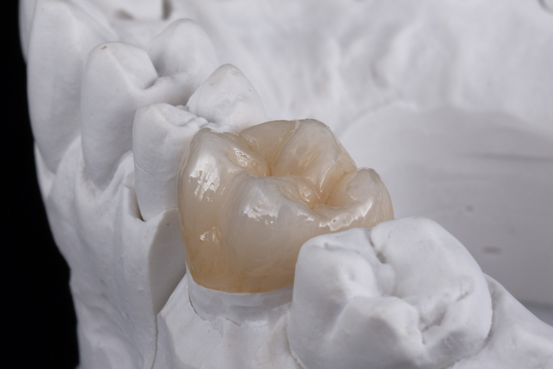 ジルコニアの歯イメージ