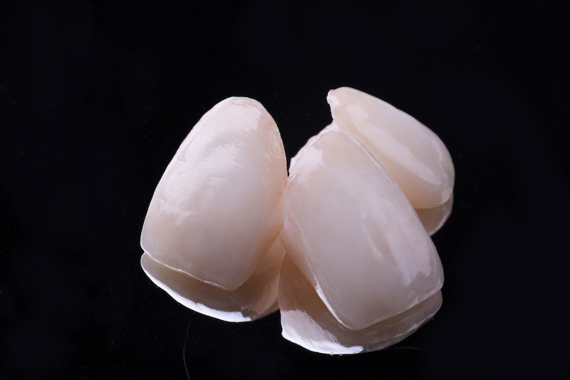 セラミックの歯