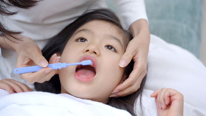 子どもの歯並びが悪くなるのを予防するための歯磨き
