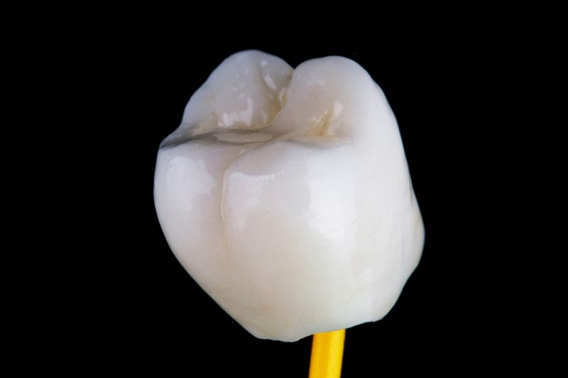 セラミックの歯の完成