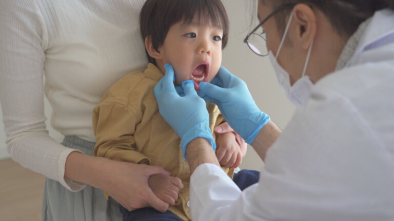 小児矯正で八重歯は治せる？治療開始時期や治療法も解説！