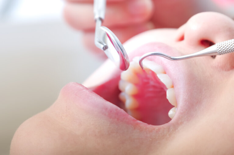 セラミック治療で歯を削るケースとは？歯を削るメリットも解説