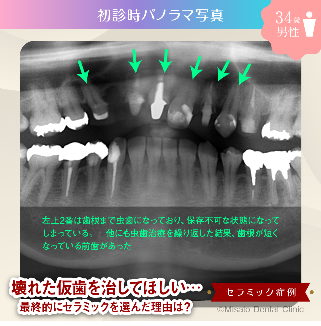 初診時パノラマ写真