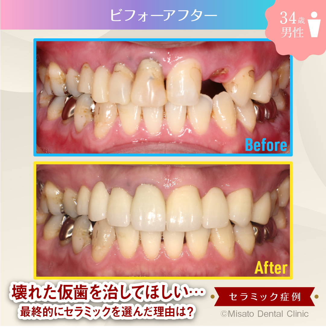 ビフォーアフター