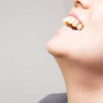 大人の出っ歯のイメージ