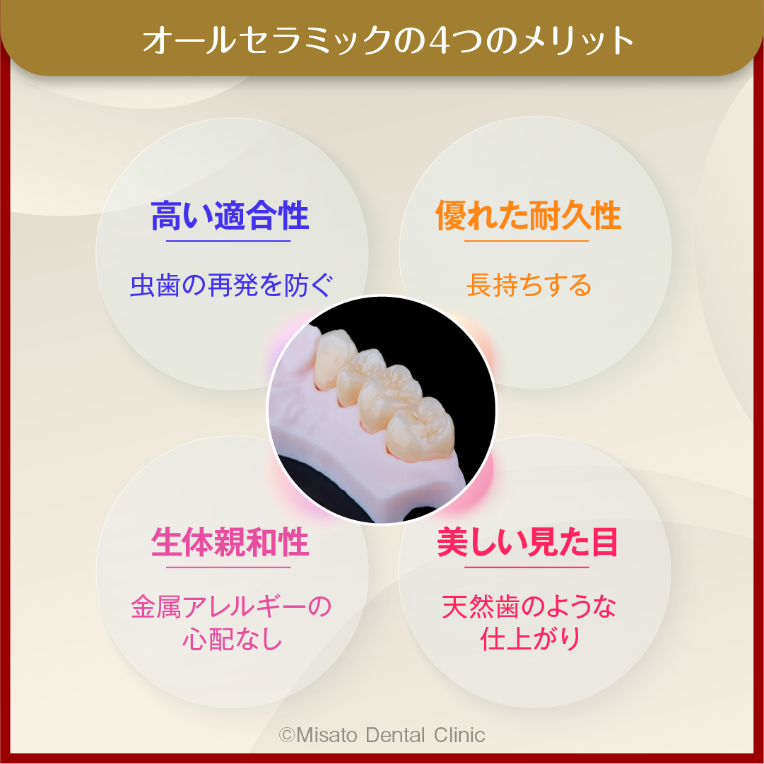 オールセラミックの4つのメリット