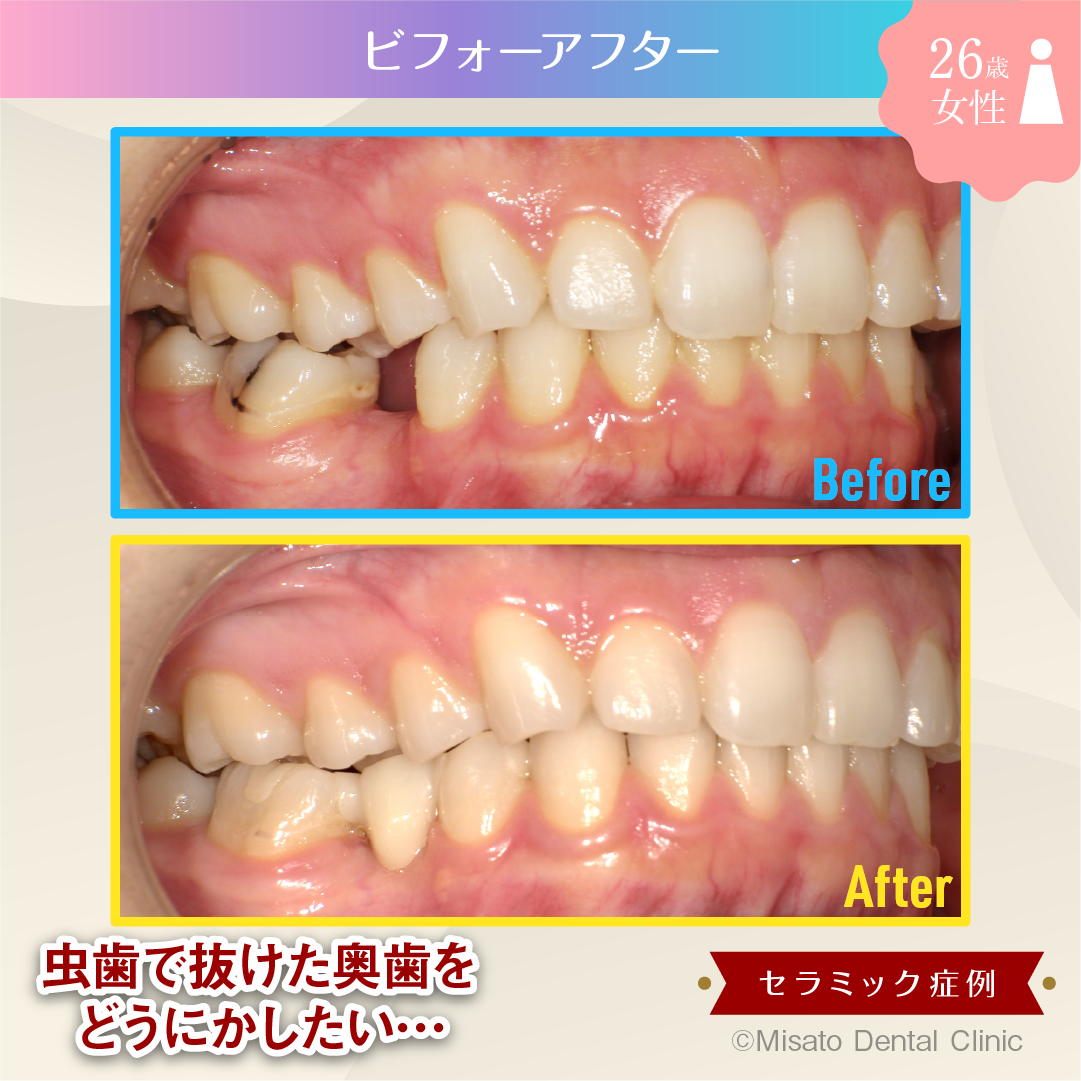 ビフォーアフター