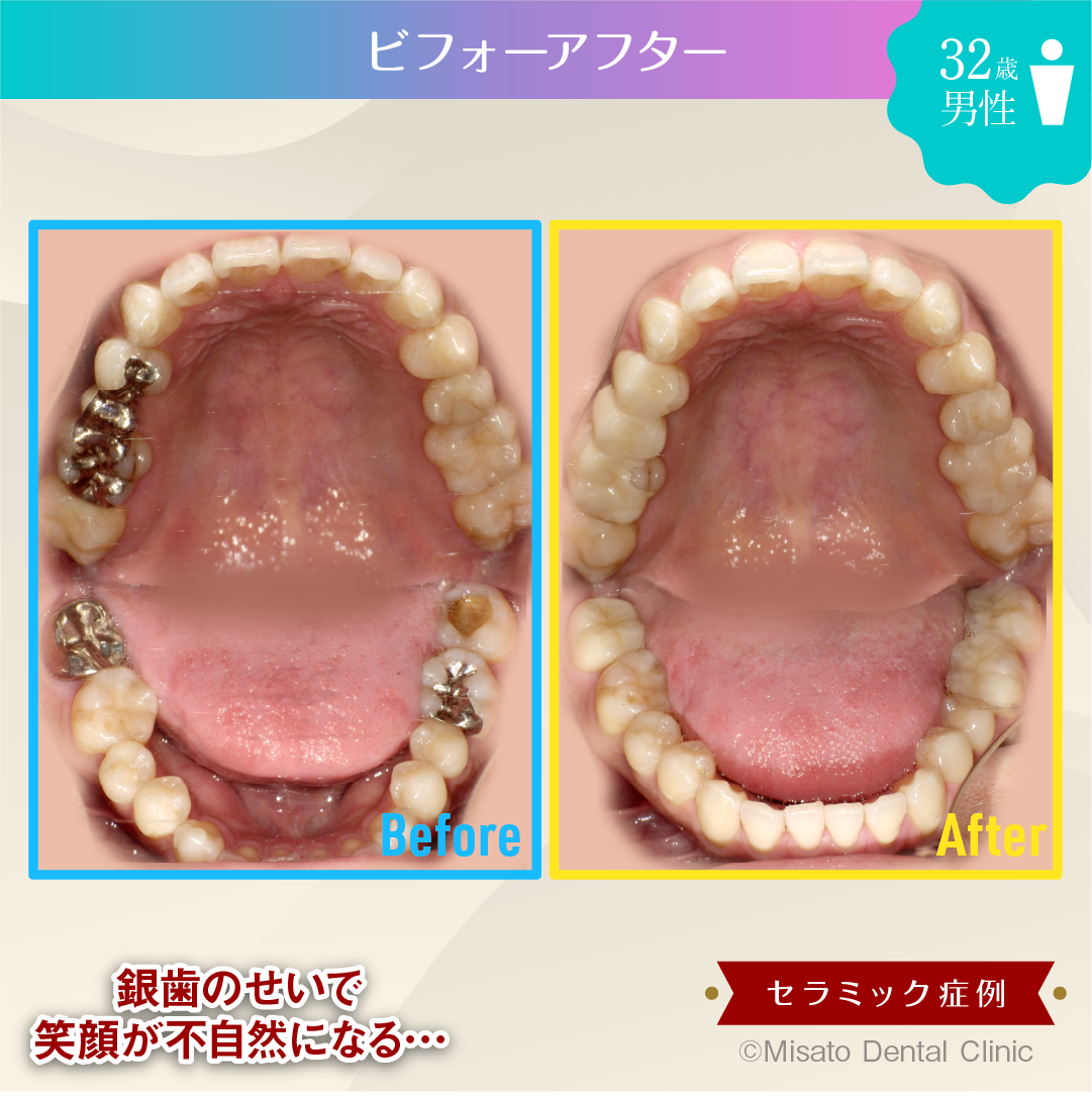 ビフォーアフター