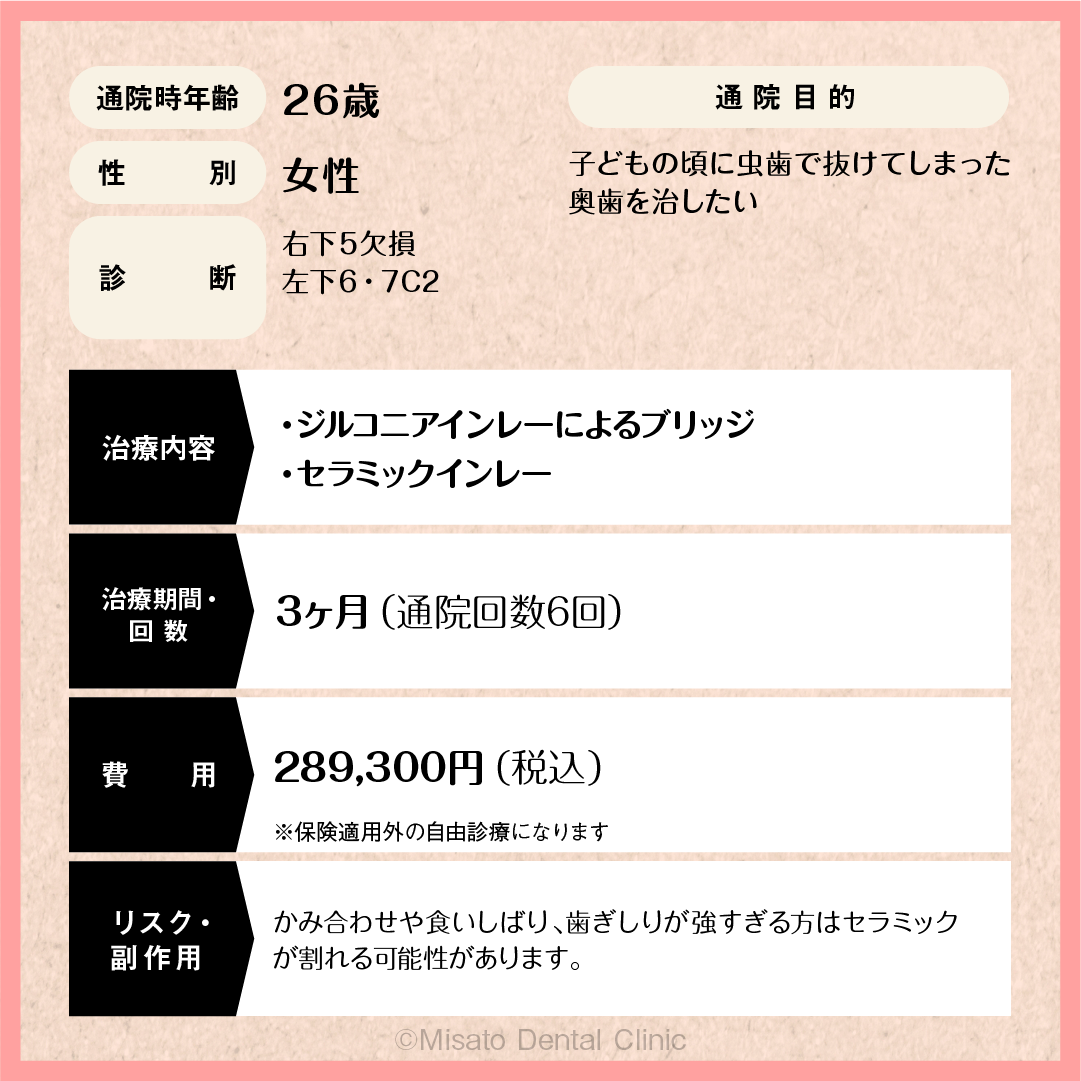 限定解除項目