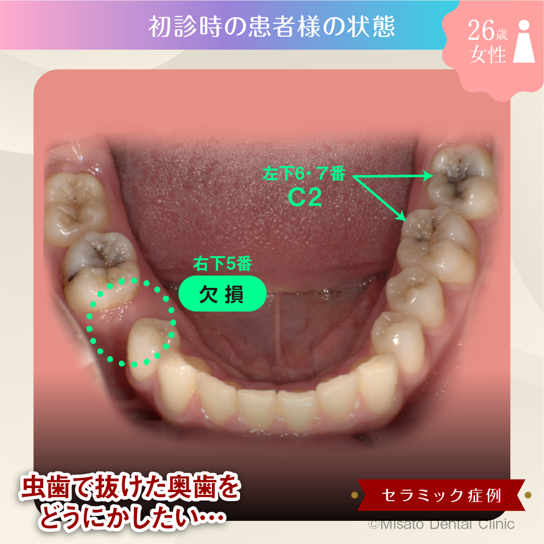 初診時の患者様の状態