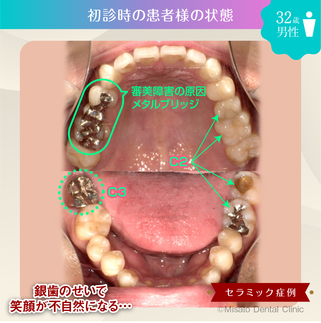 初診時の患者様の状態