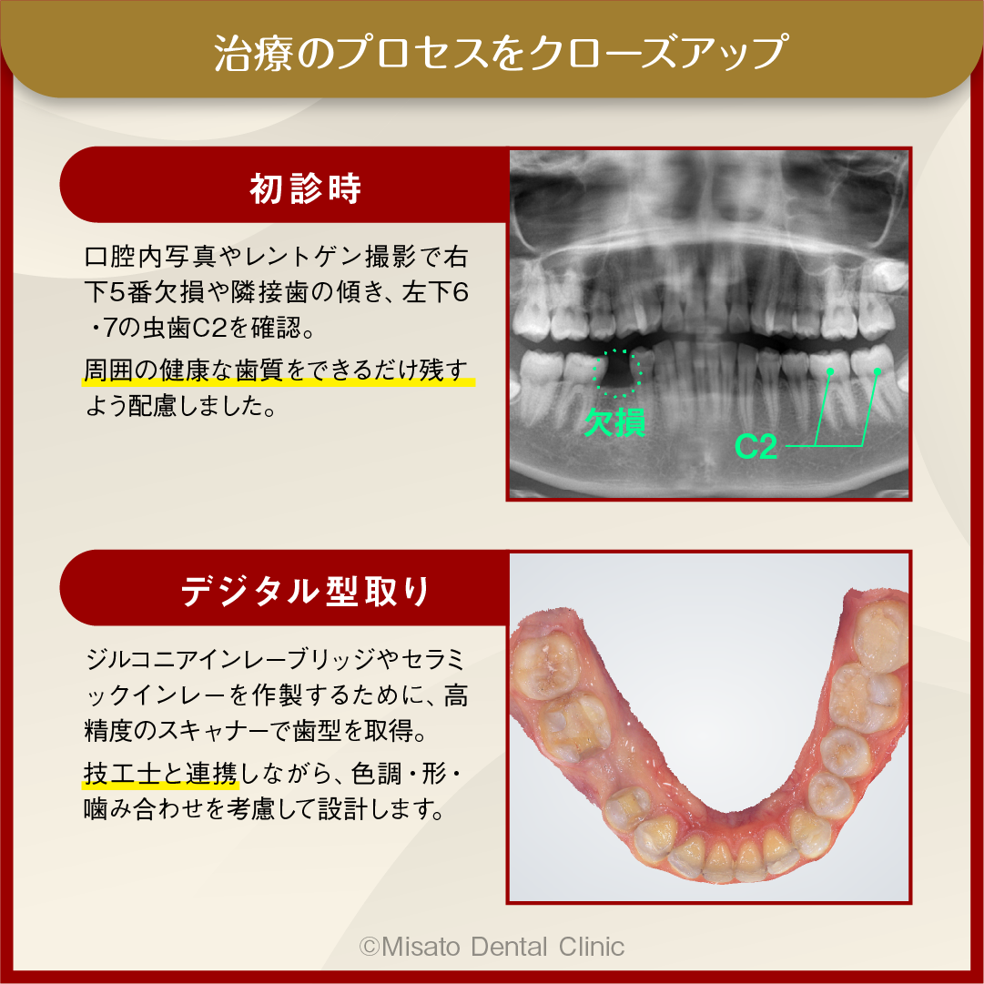 治療のプロセスをクローズアップ