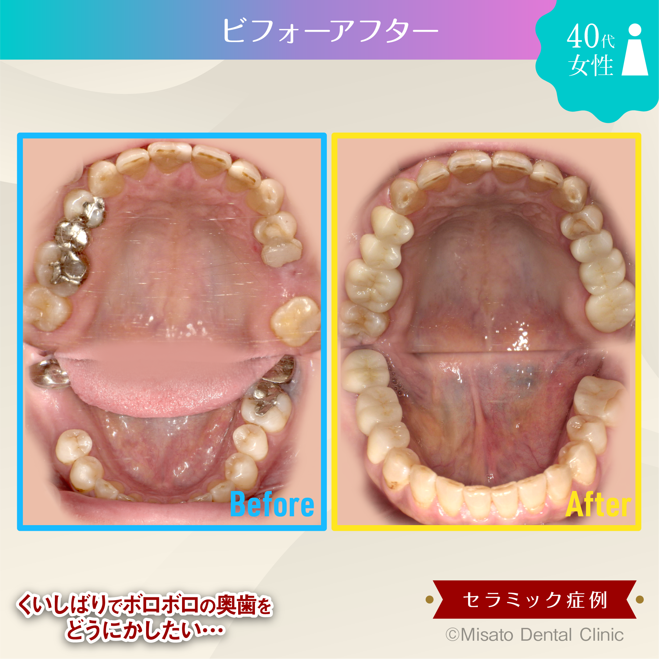 ビフォーアフター