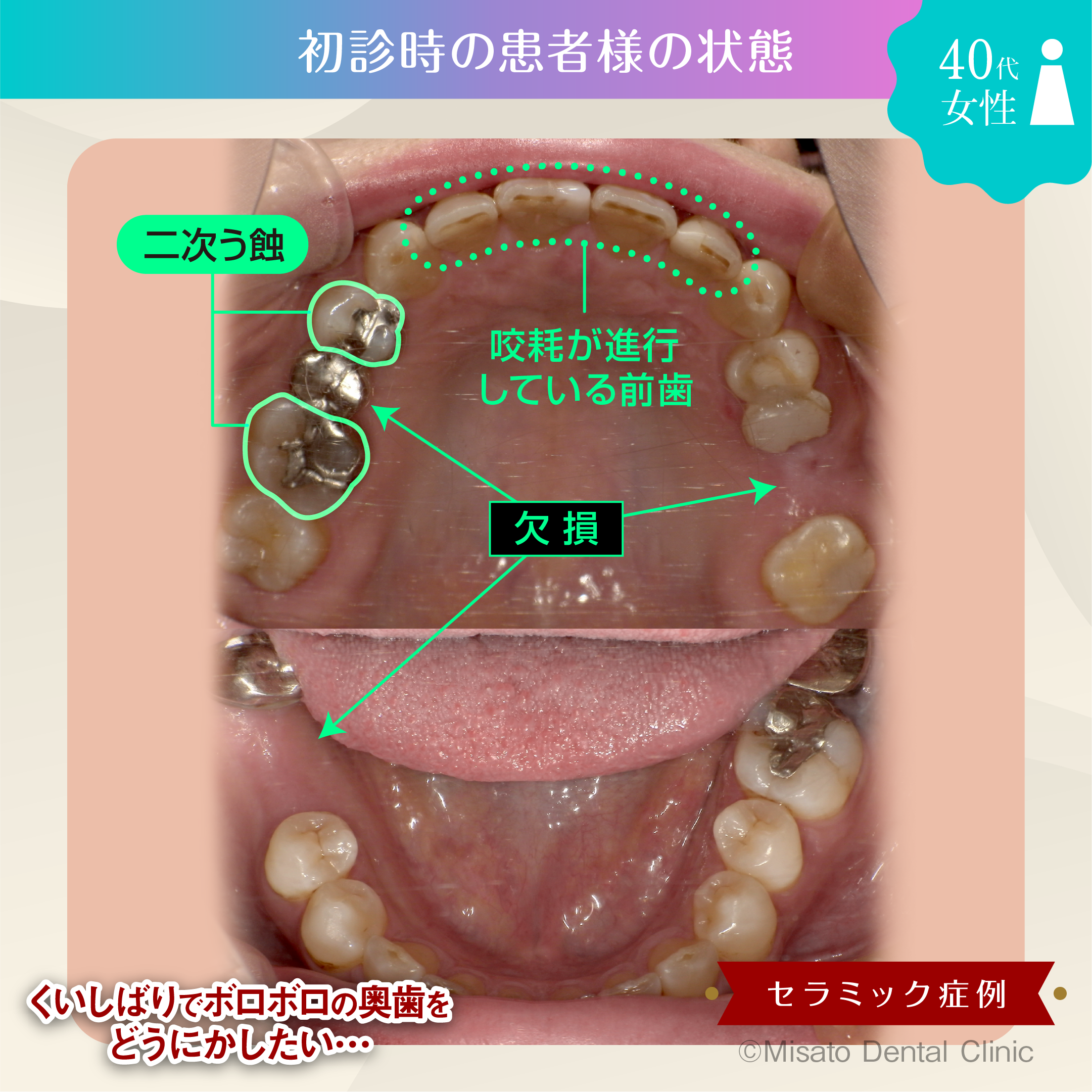 初診時の状態