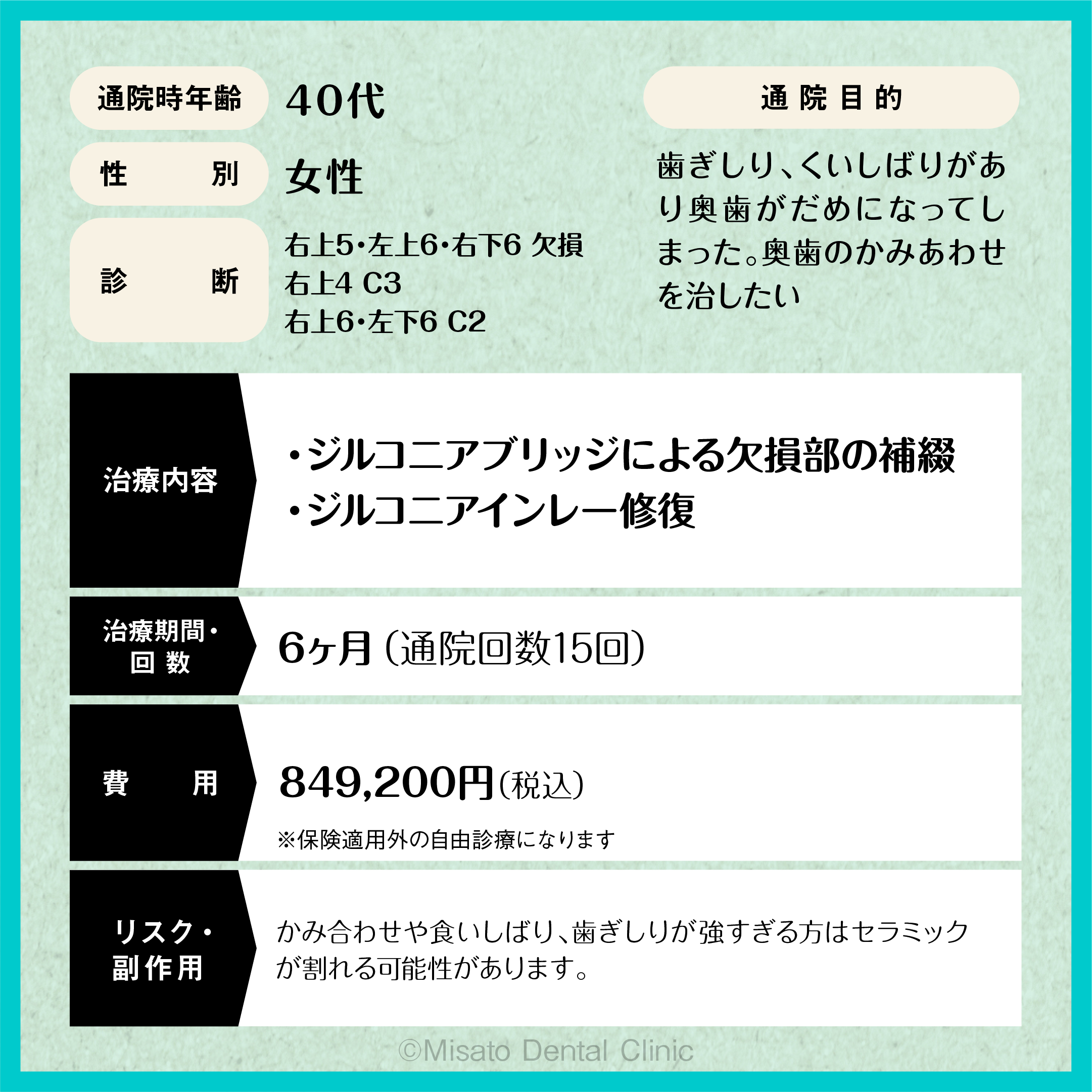 限定解除項目