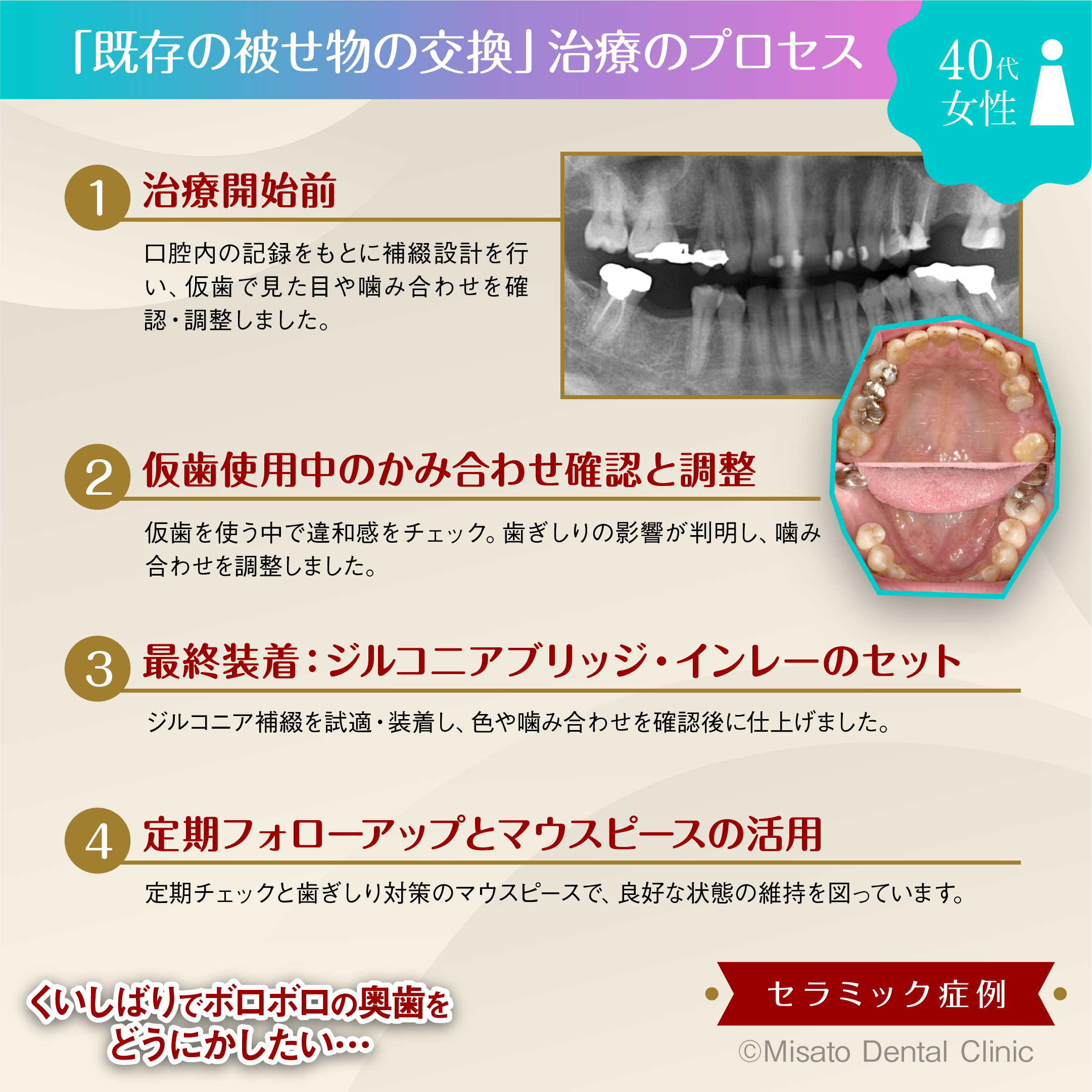 治療のプロセス