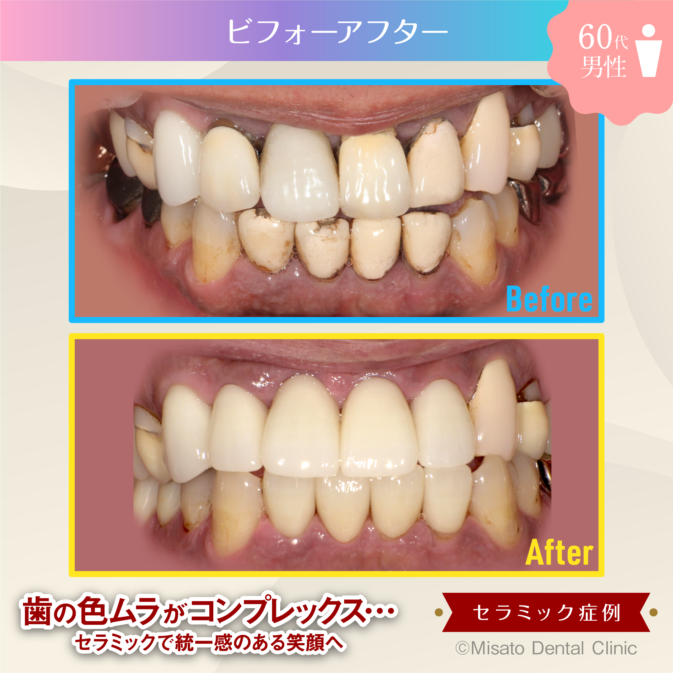 ビフォーアフター