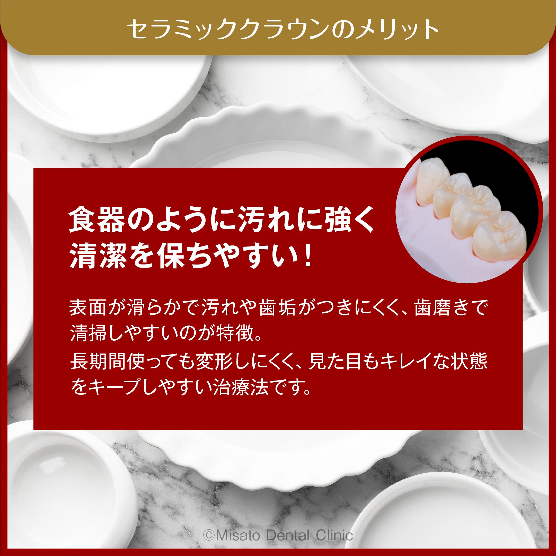 セラミッククラウンのメリット