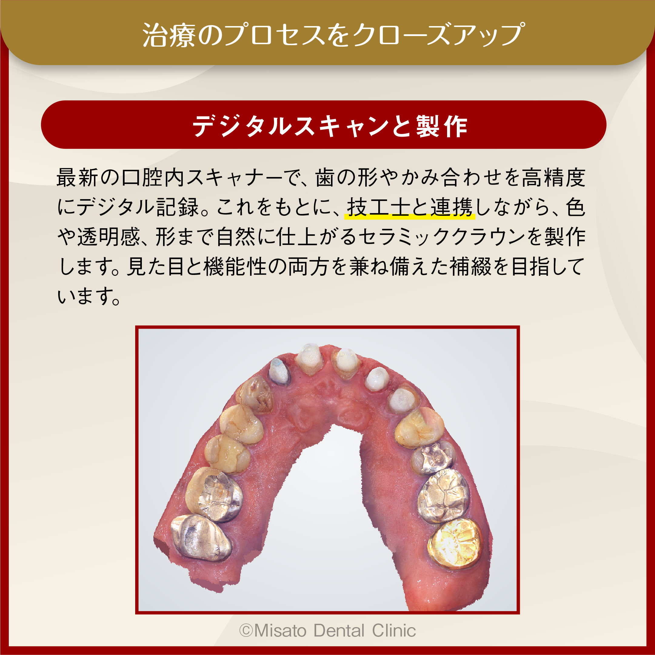 治療のプロセスをクローズアップ