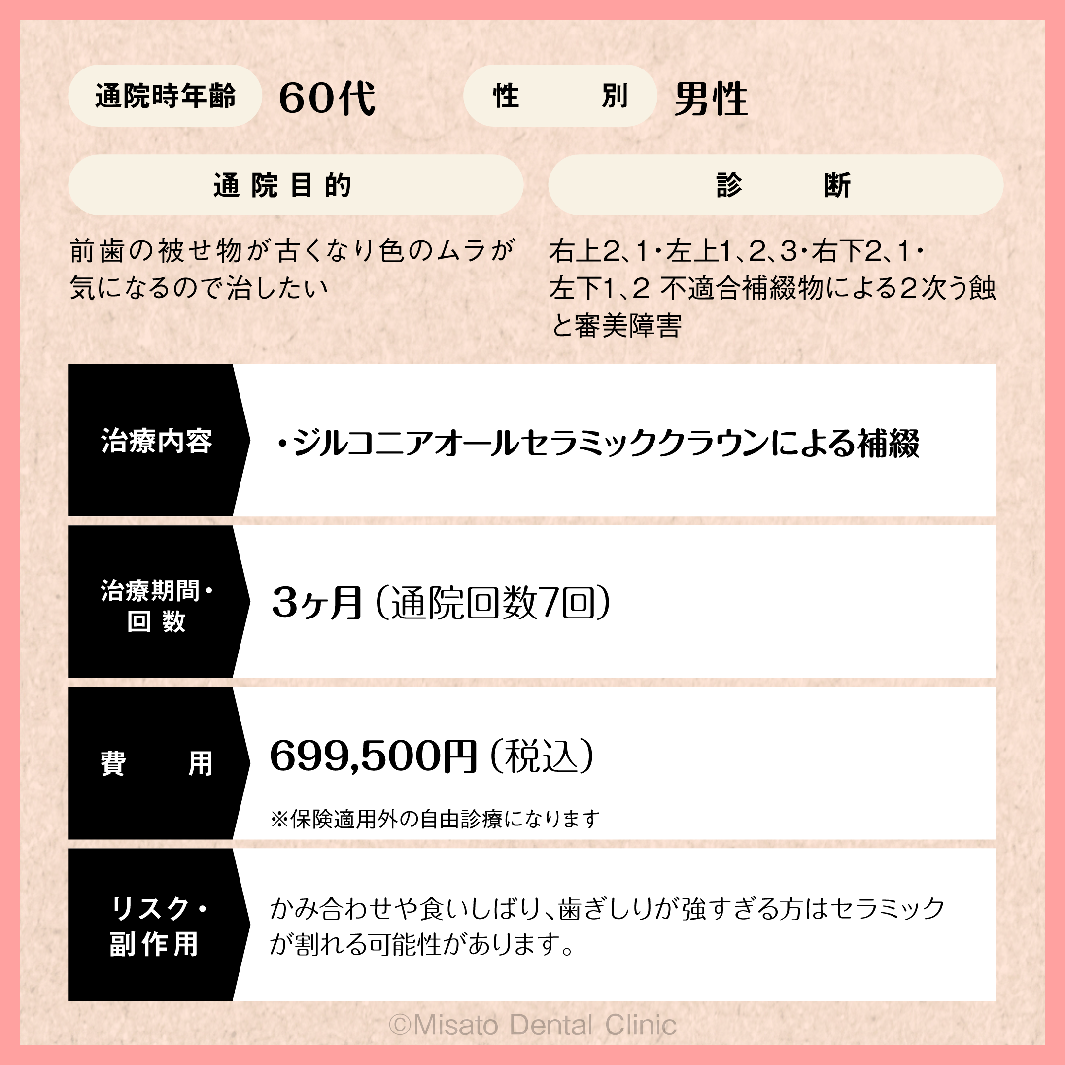 限定解除項目
