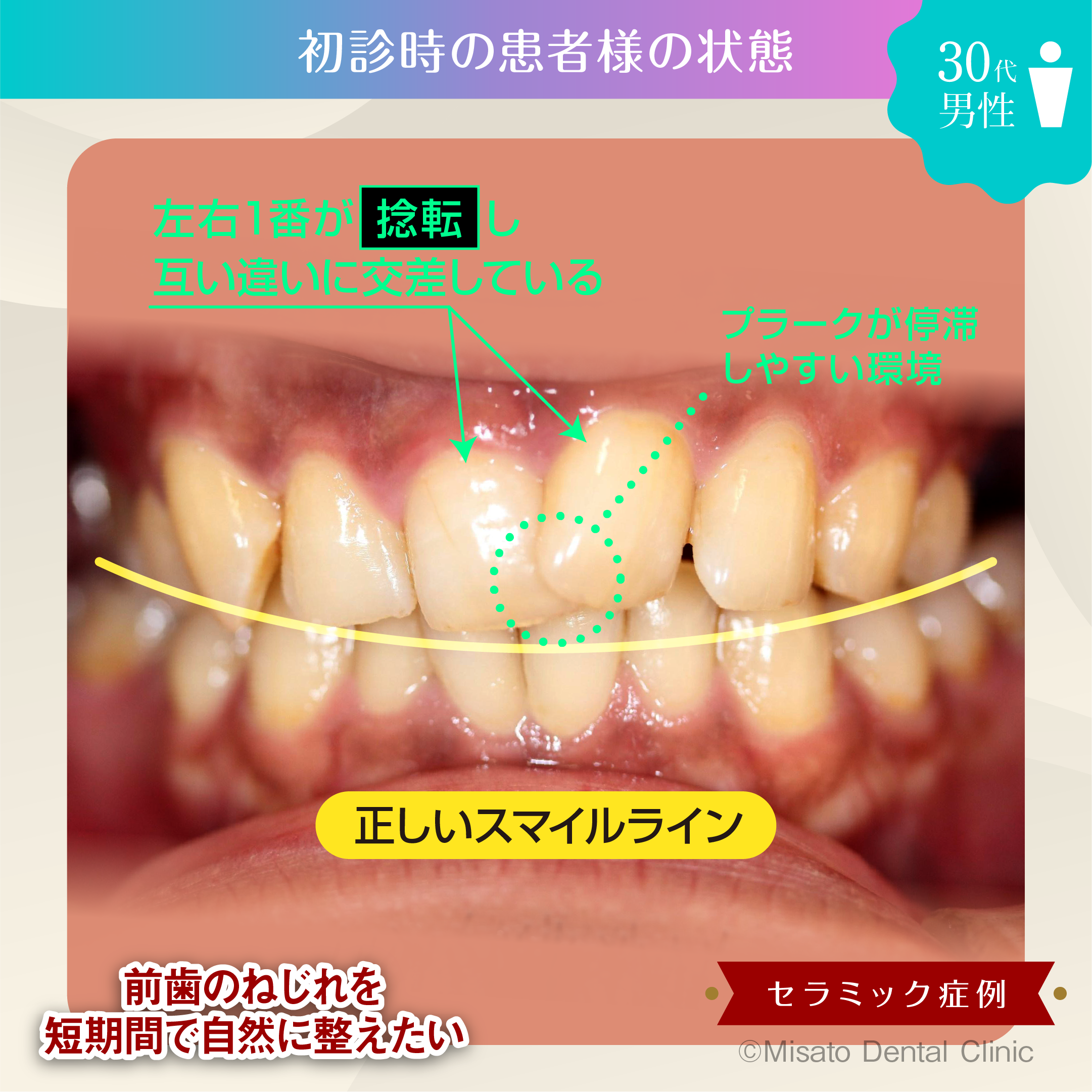 治療内容 - 初診時の状態