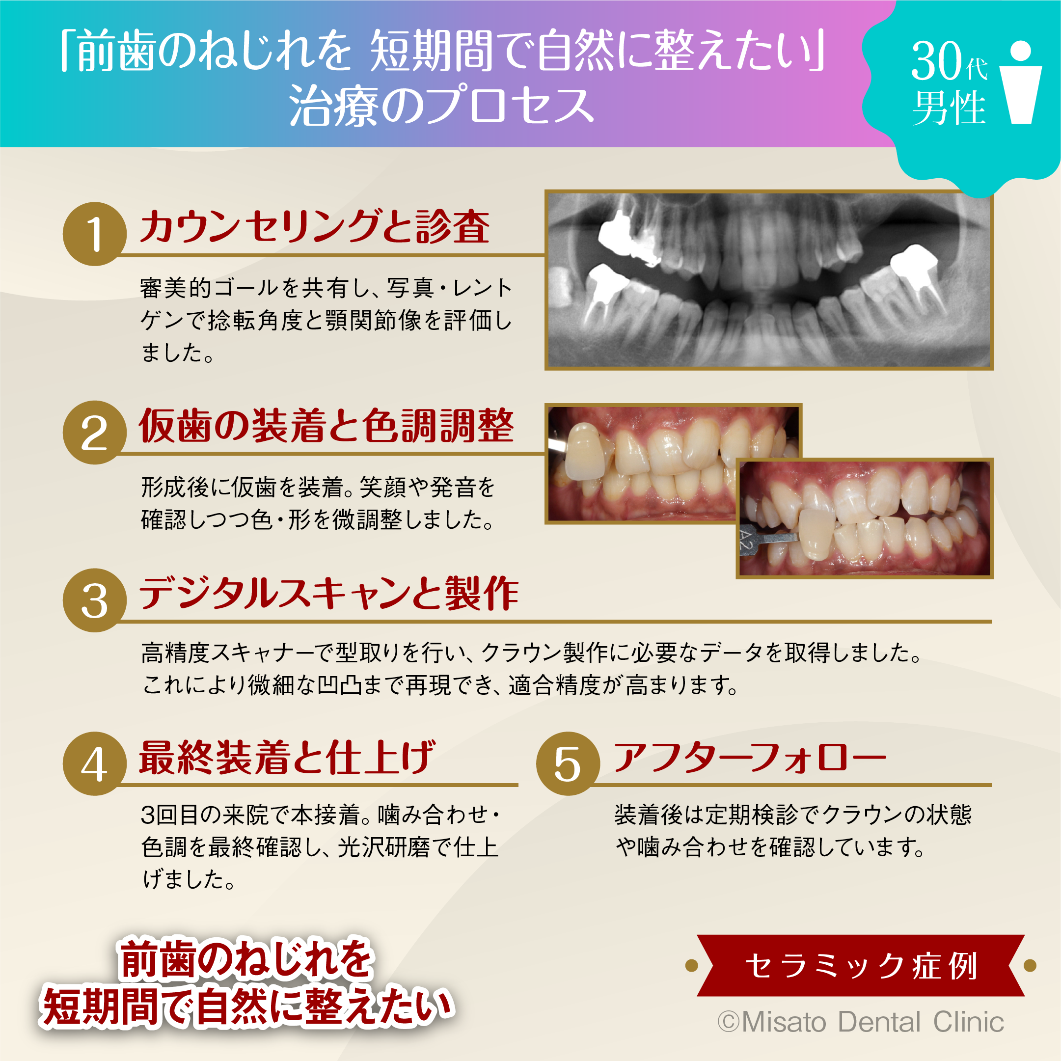 治療のプロセス