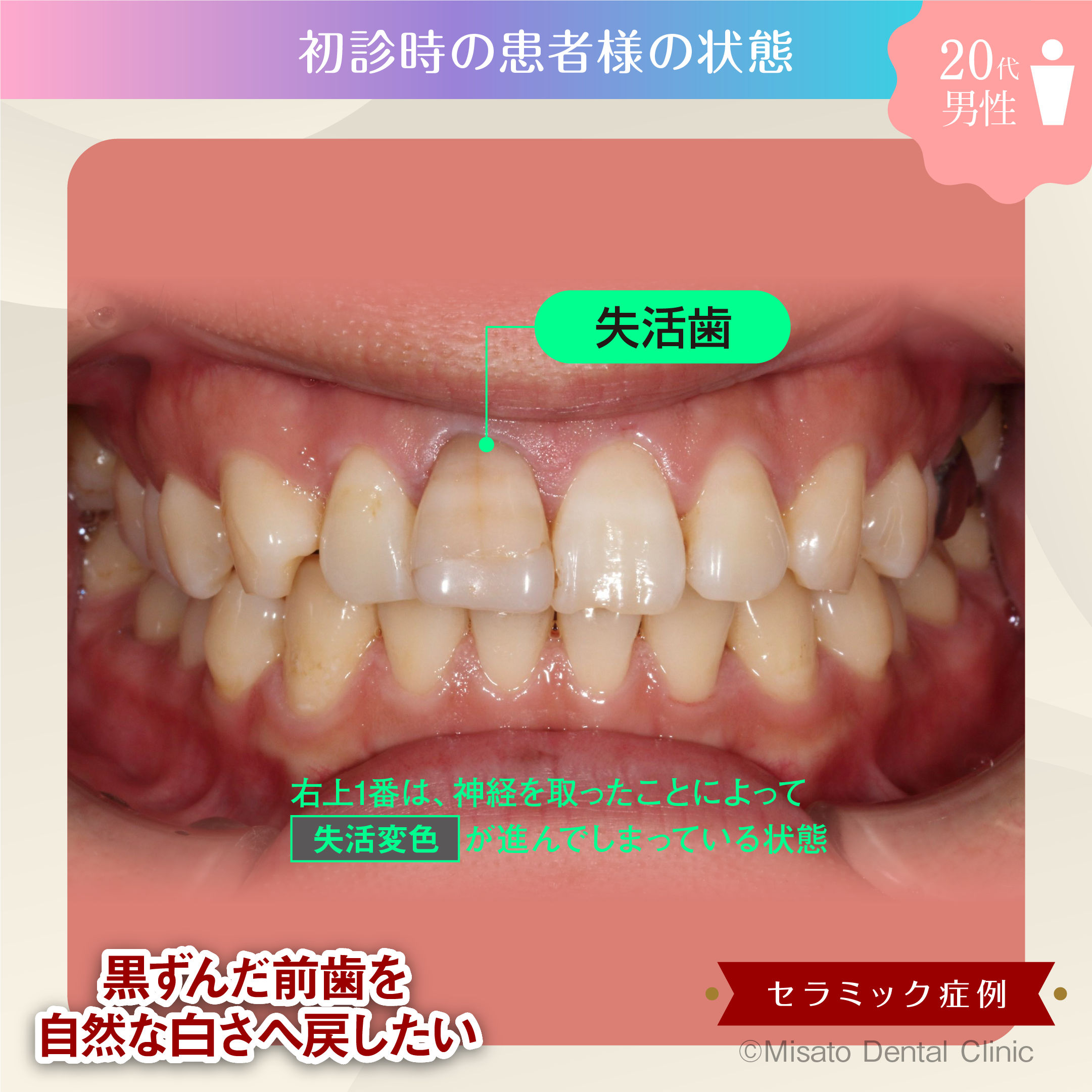 初診時の状態
