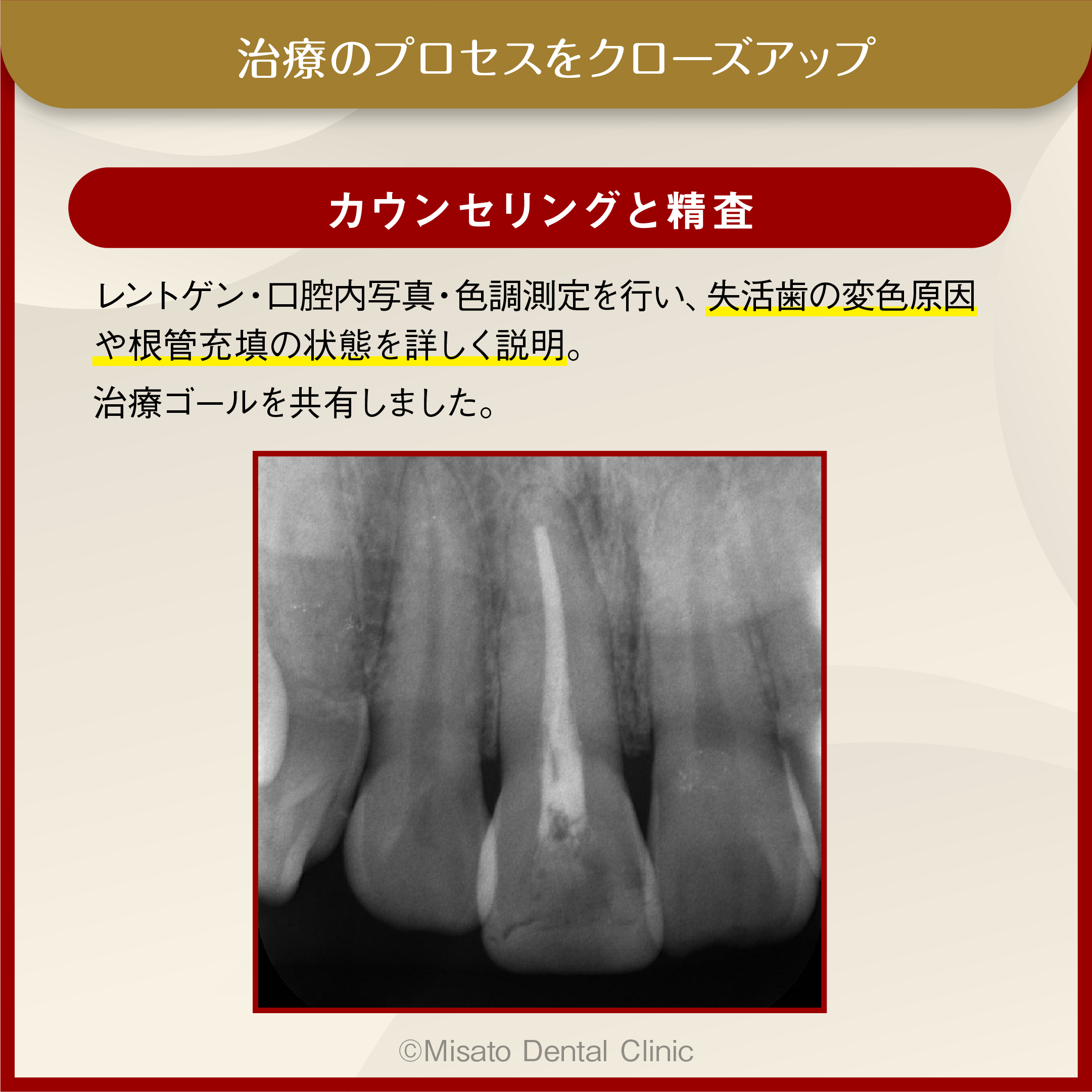 治療のプロセスをクローズアップ_カウンセリングと精査