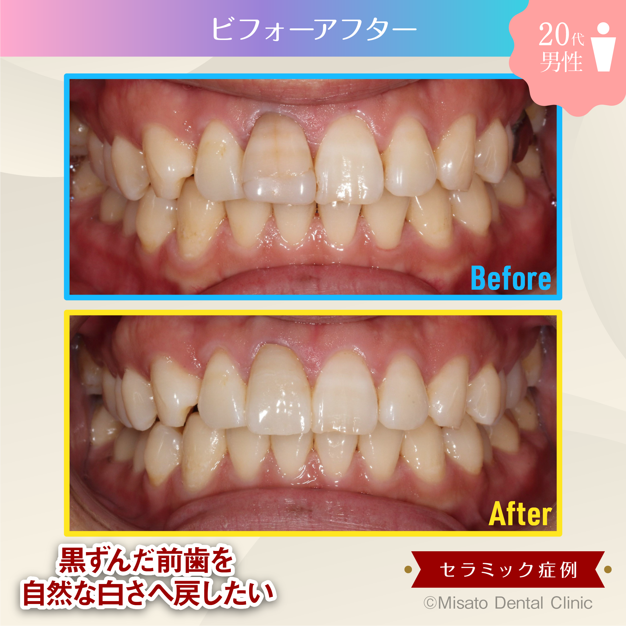 ビフォーアフター