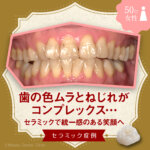 歯の色ムラとねじれがコンプレックス…セラミックで統一感のある笑顔へ