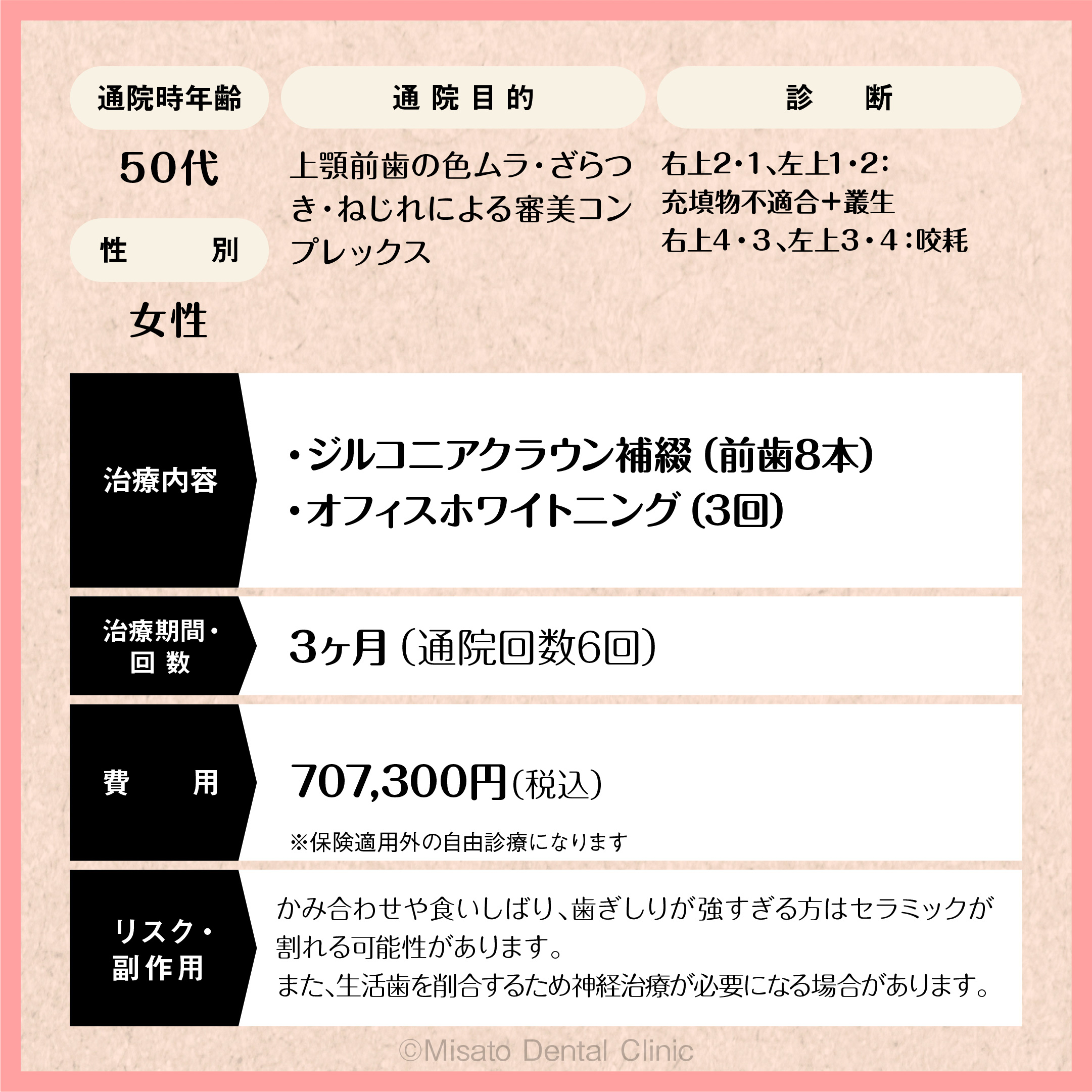 限定解除項目