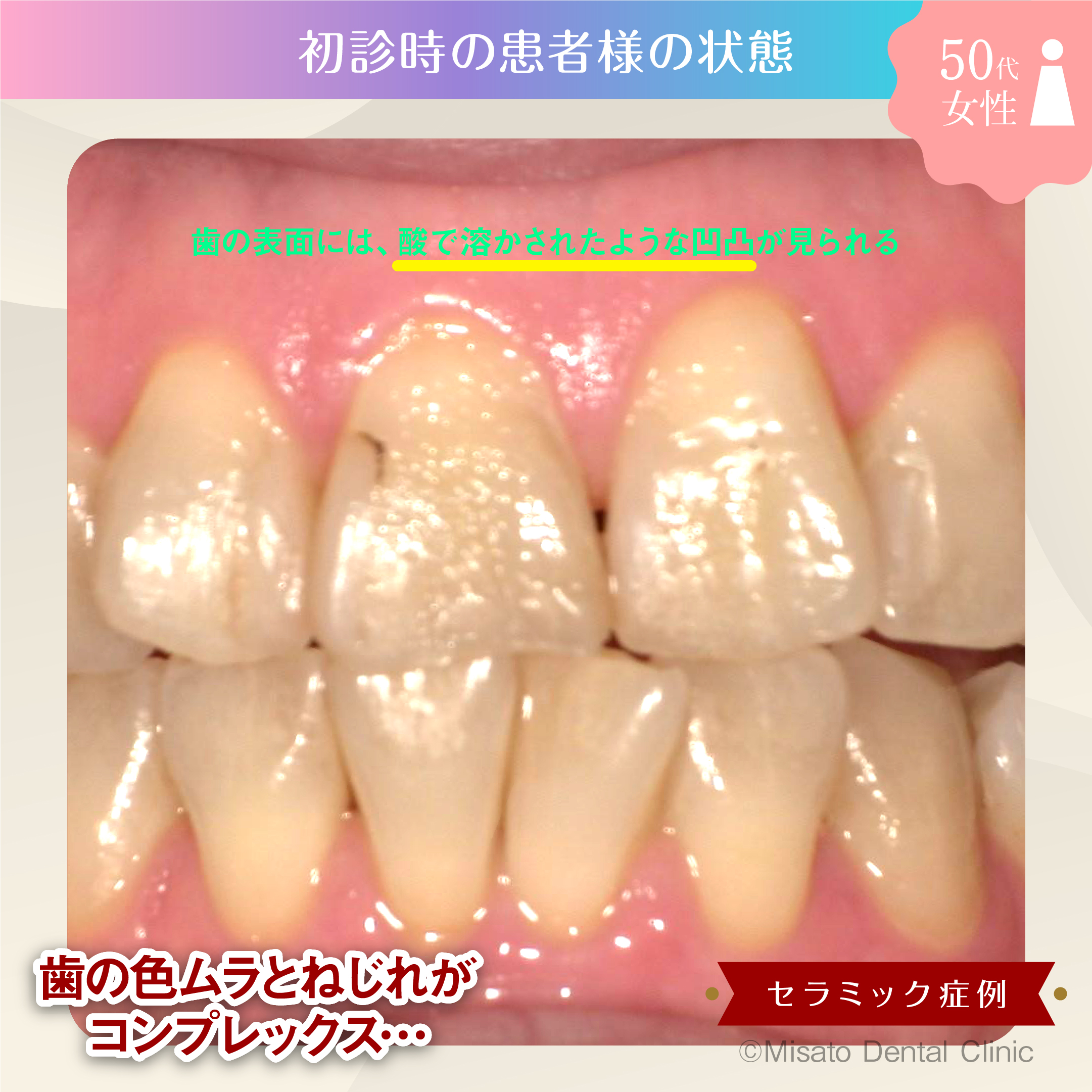 初診時の状態クローズアップ