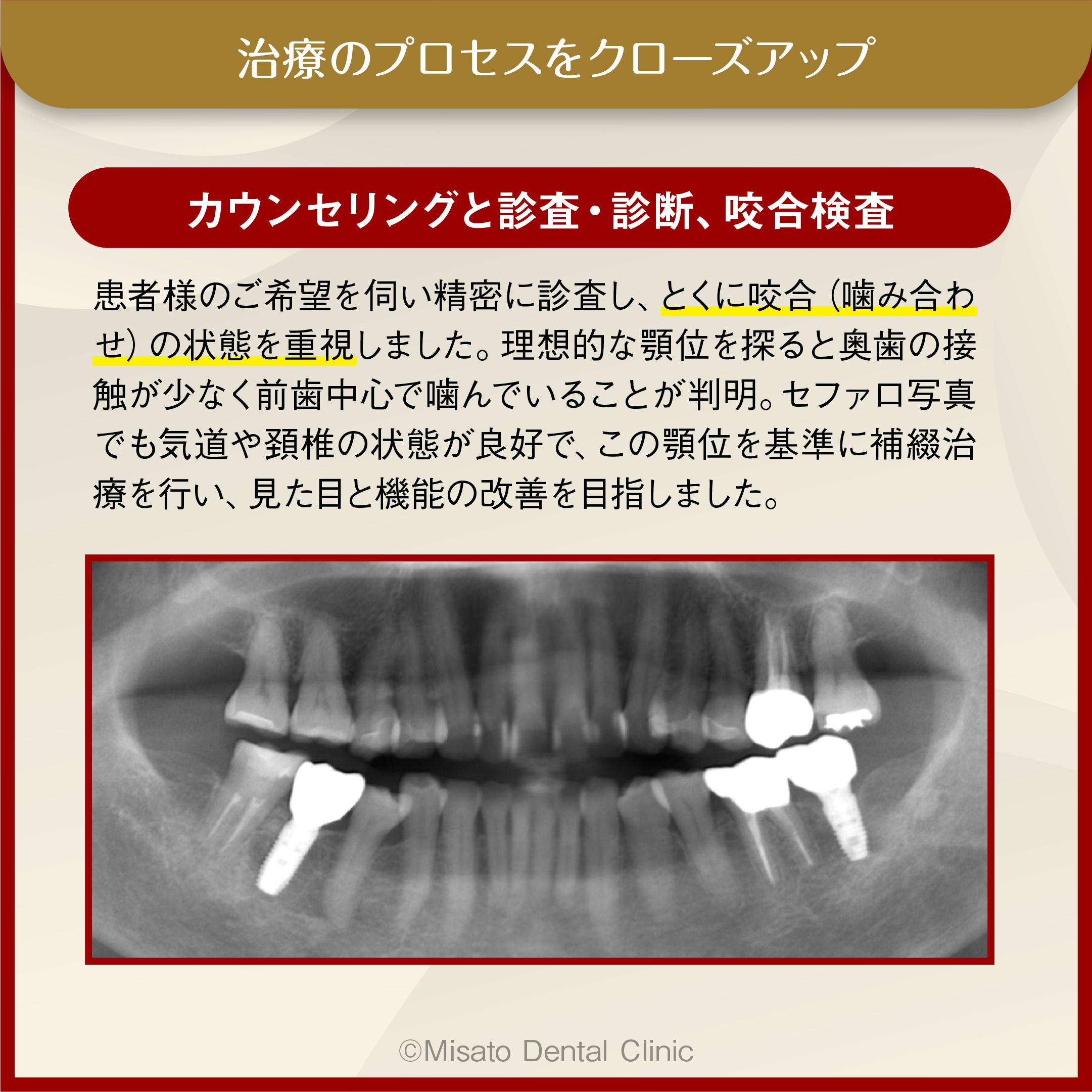 治療のプロセスをクローズアップ_カウンセリングと精査