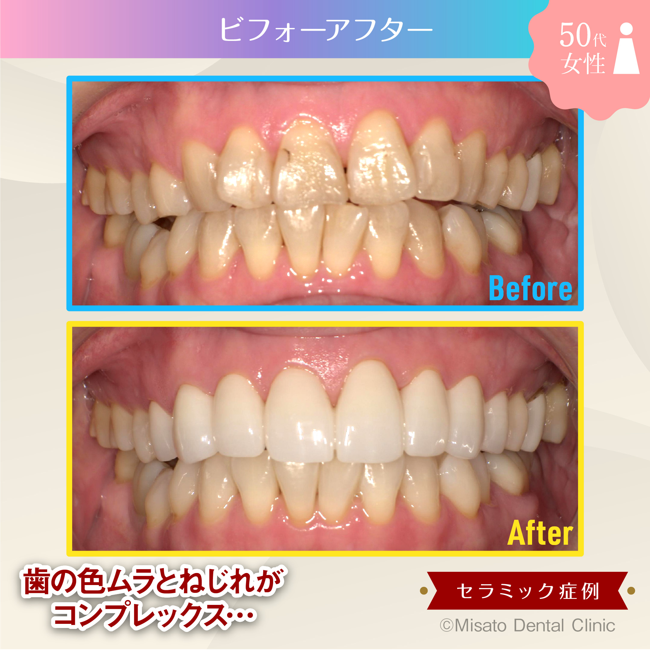 ビフォーアフター