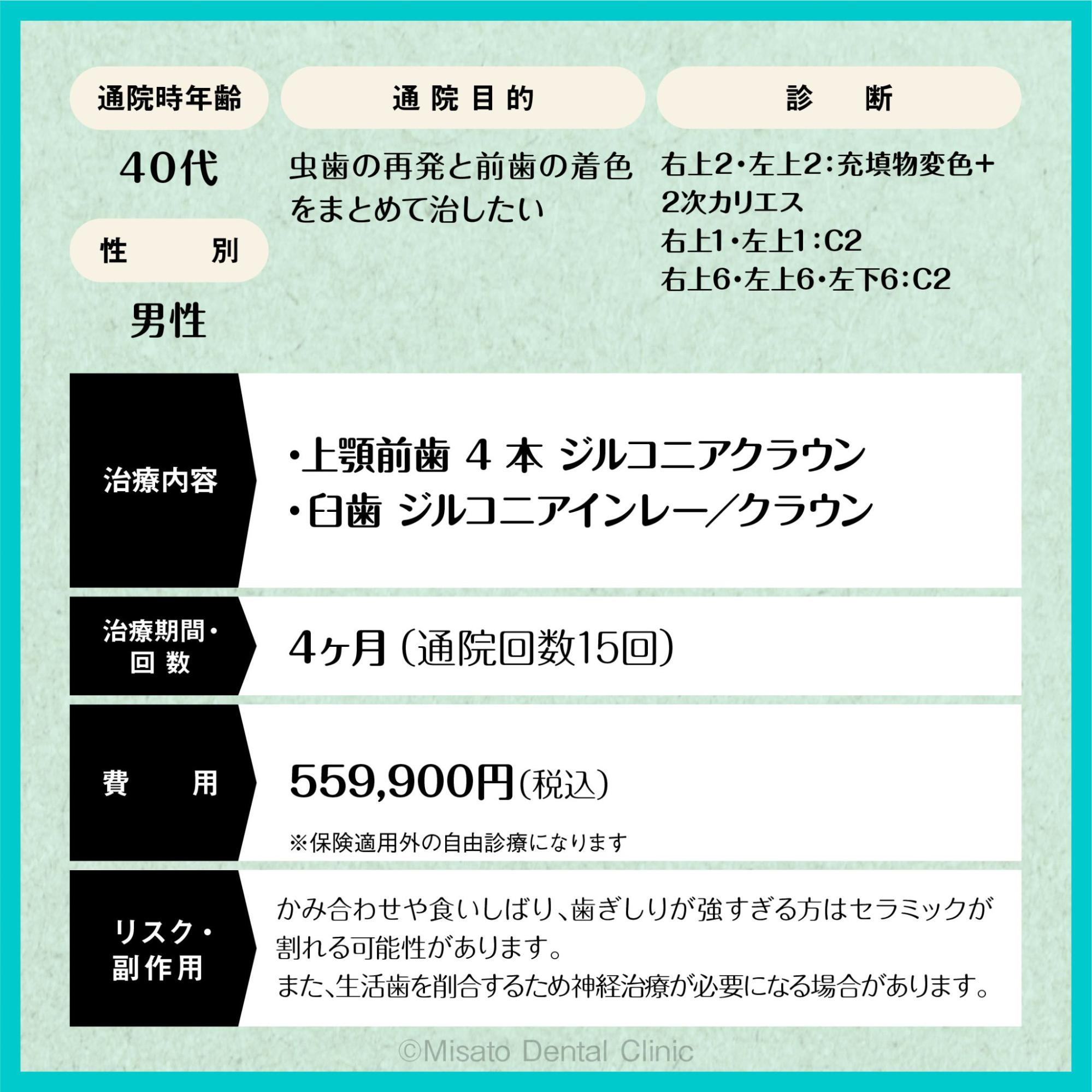 限定解除項目
