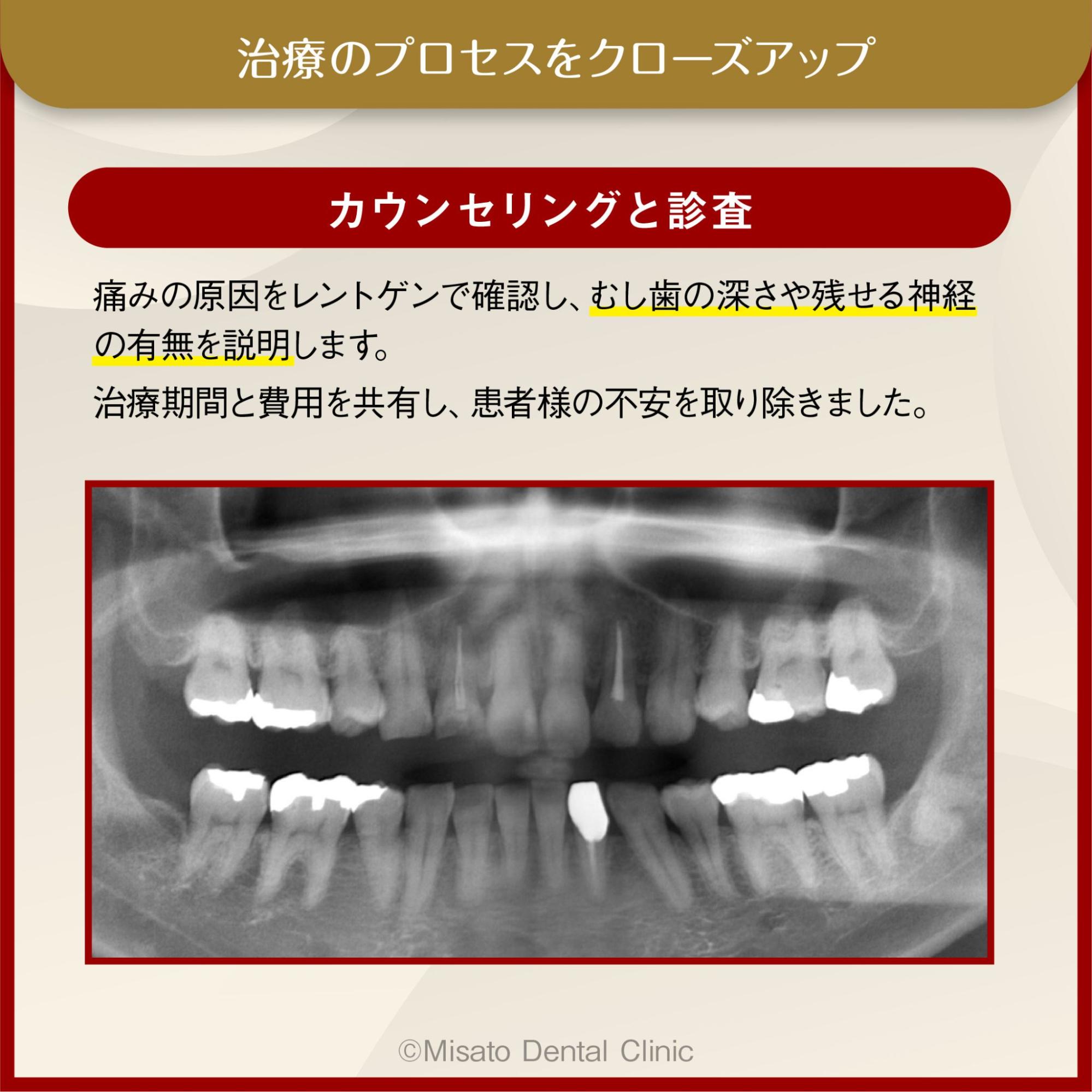 カウンセリングと診査
