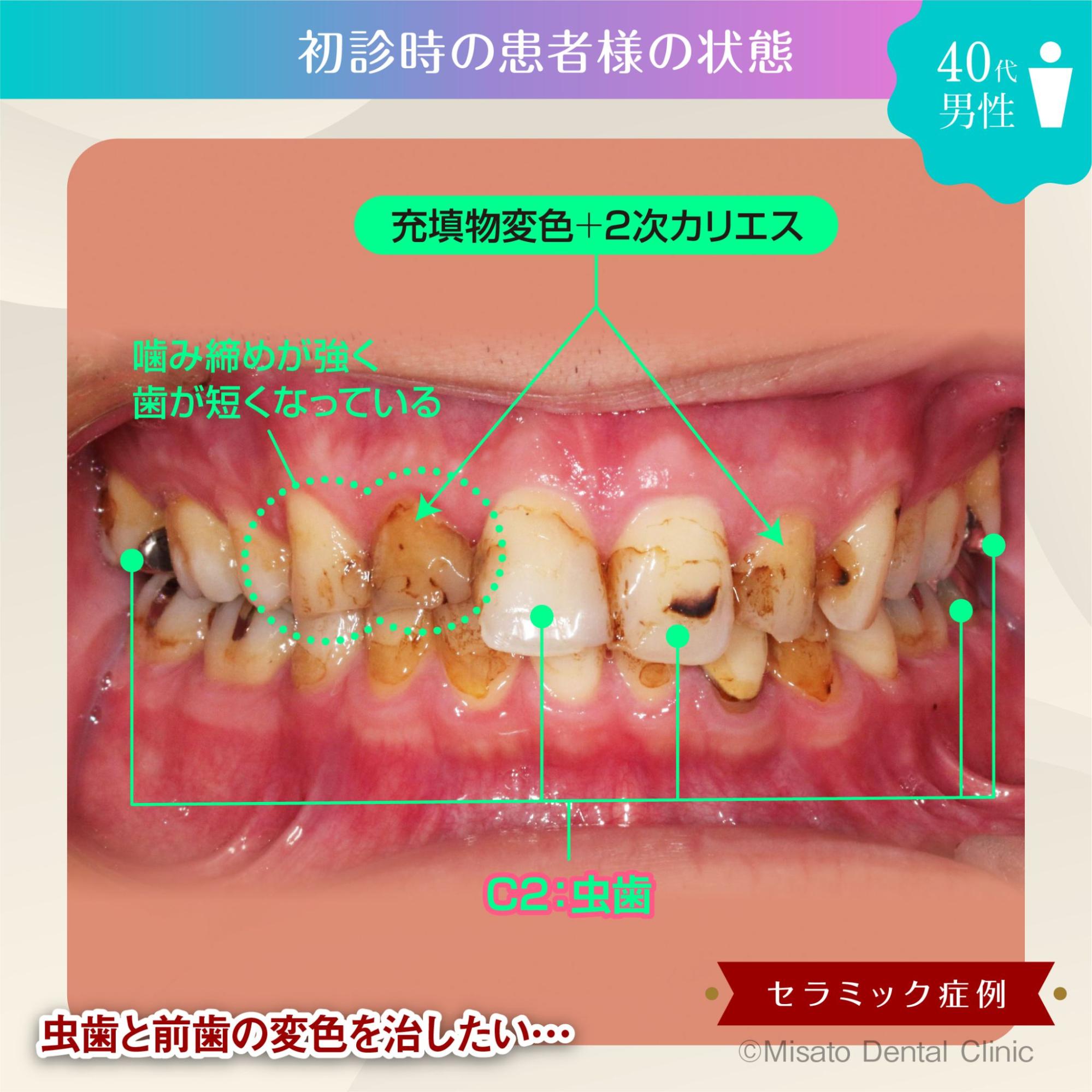 初診時の状態