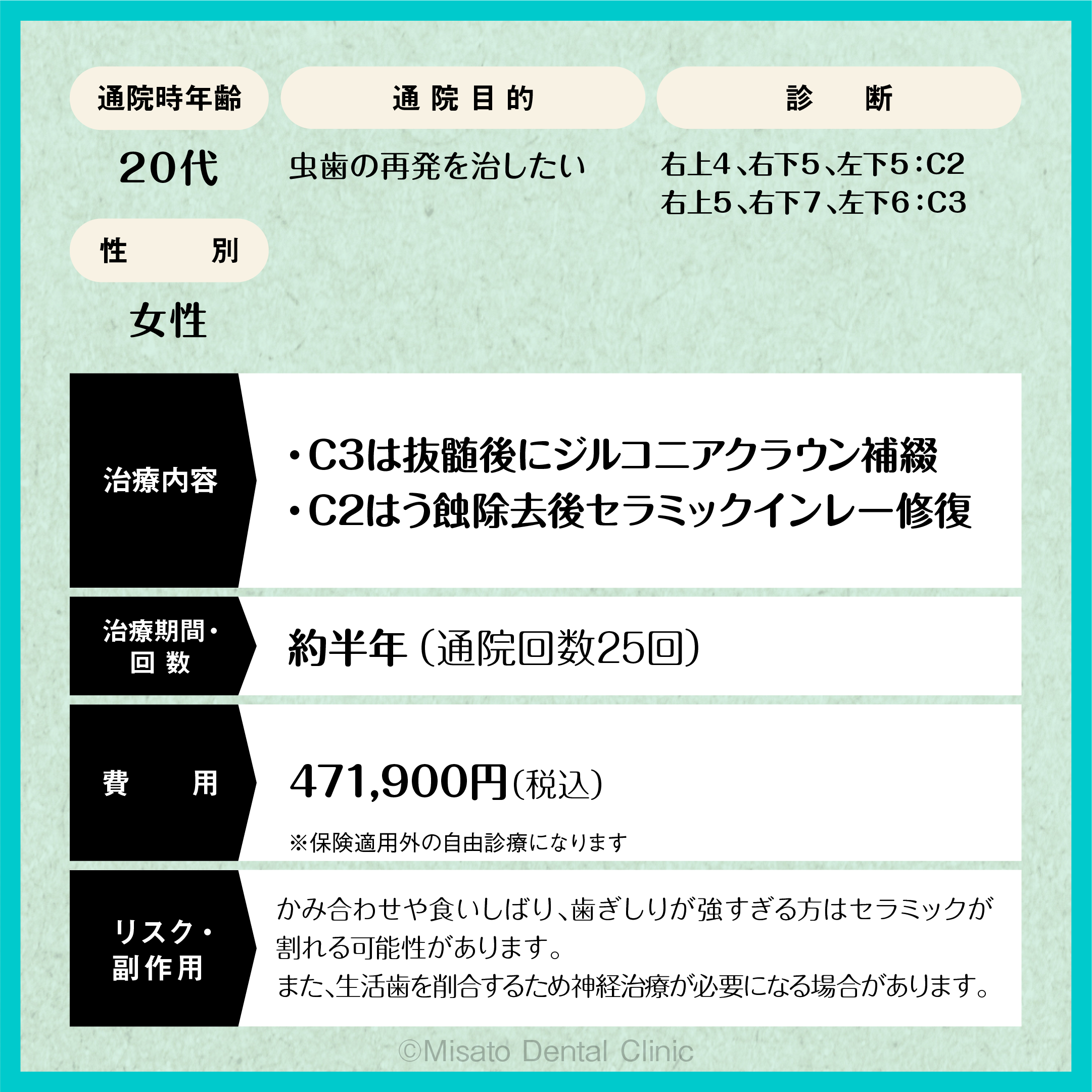 CP13の限定解除項目