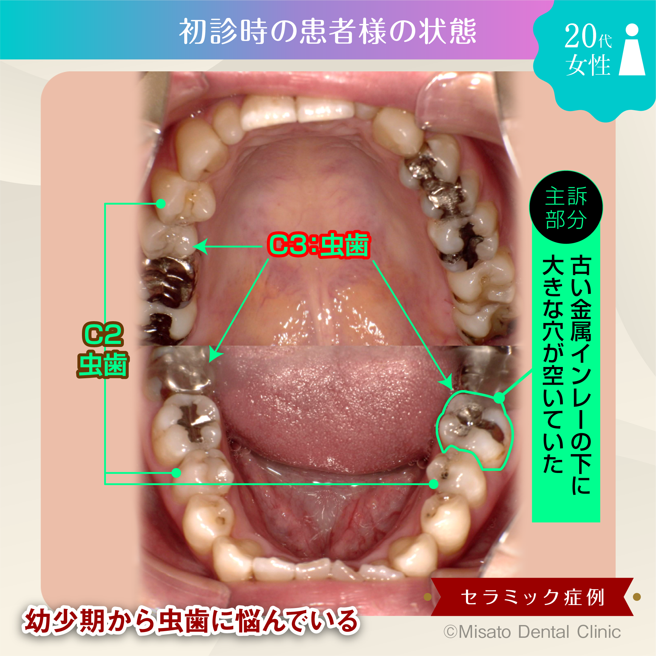 初診時の患者の状態