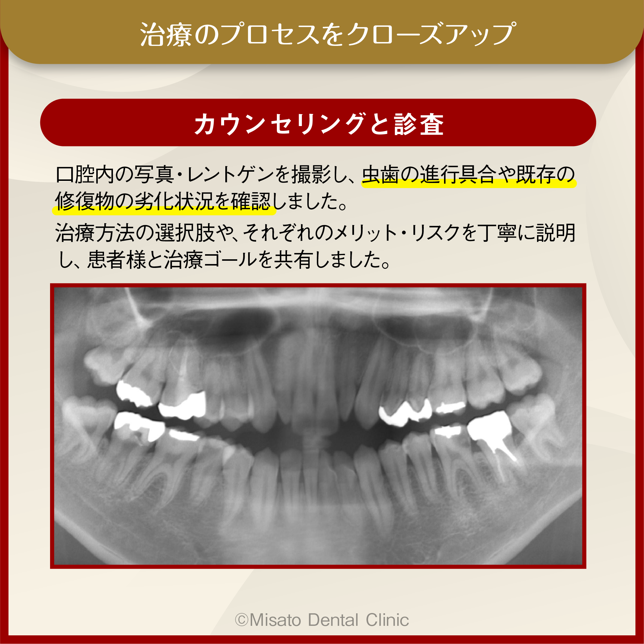 カウンセリングと診査