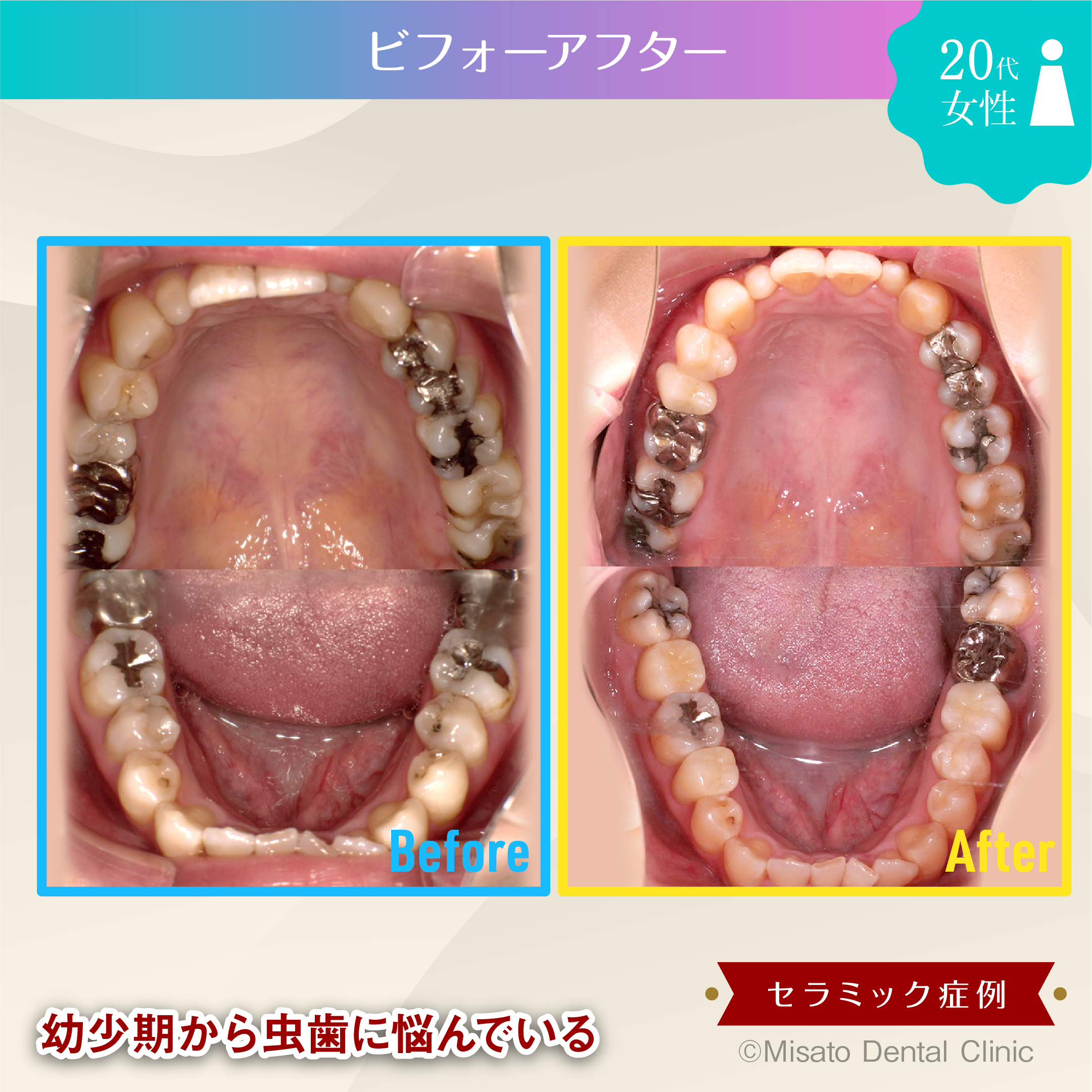 ビフォーアフター