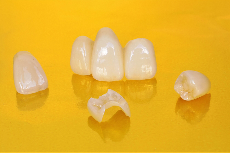 ジルコニアの歯の種類のイメージ