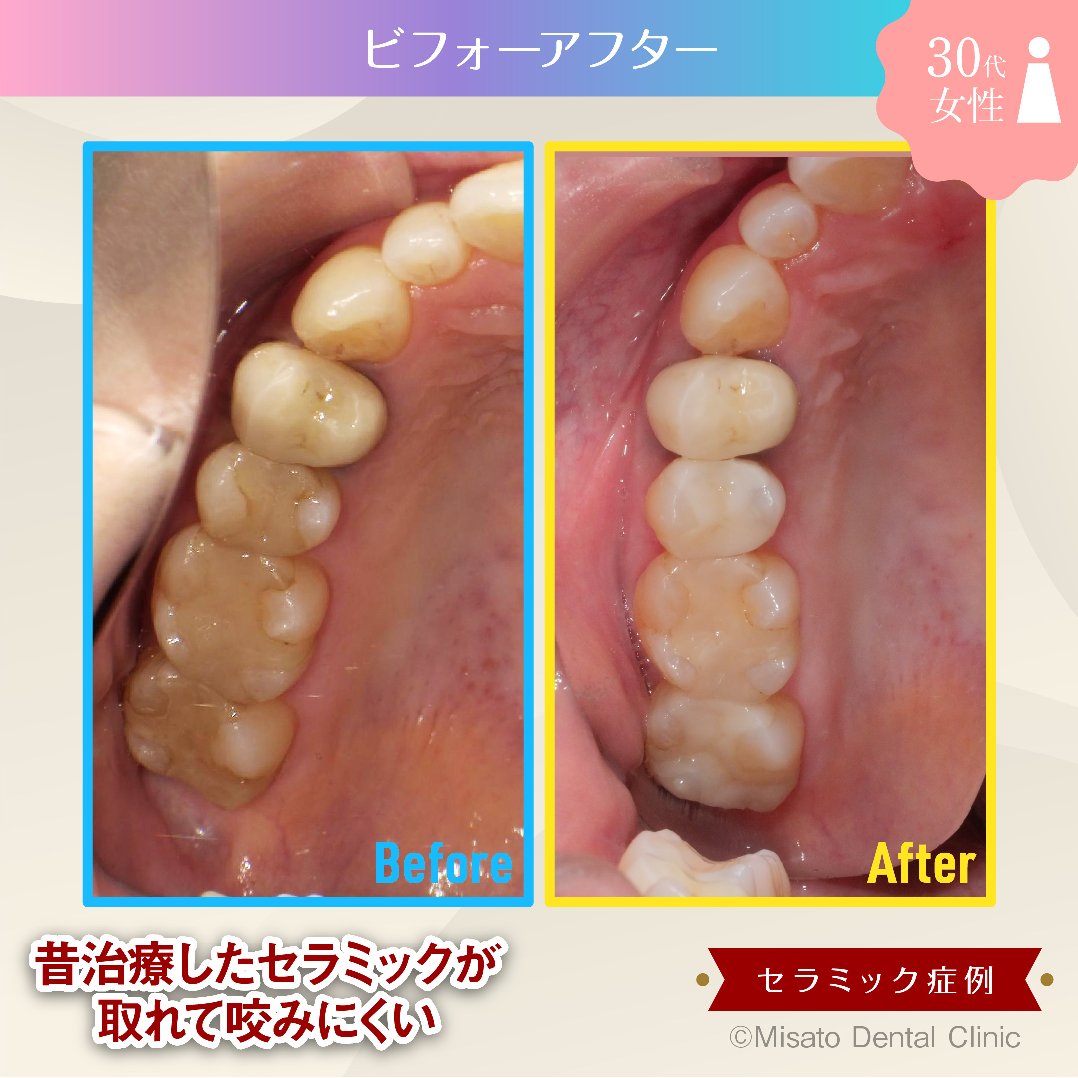 10_ビフォーアフター