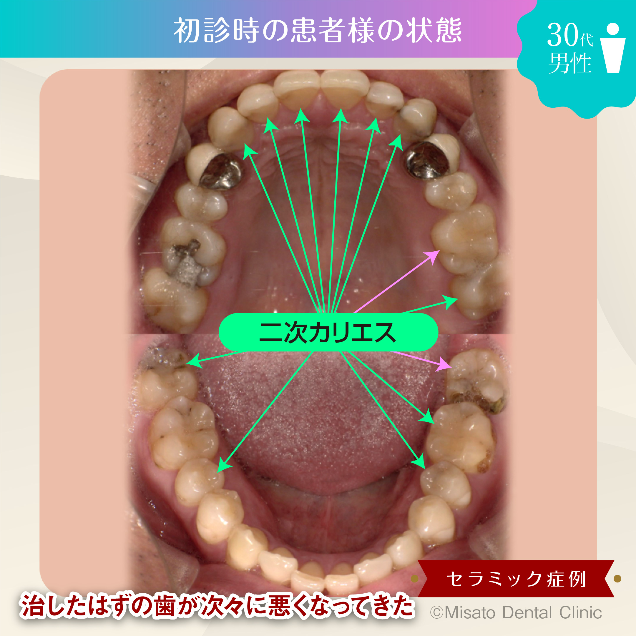 3_初診時の状態