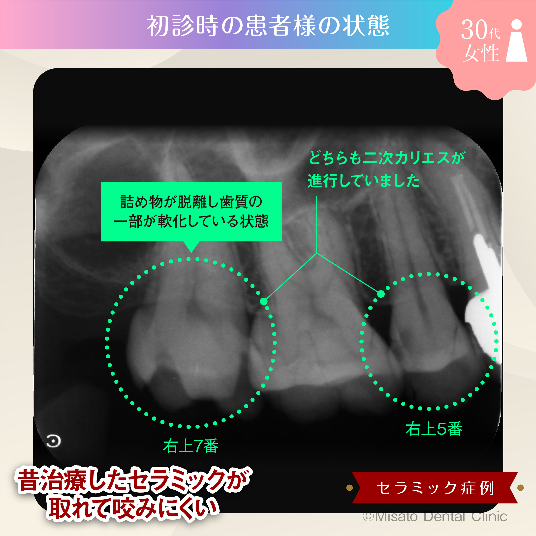 初診時の状態クローズアップ