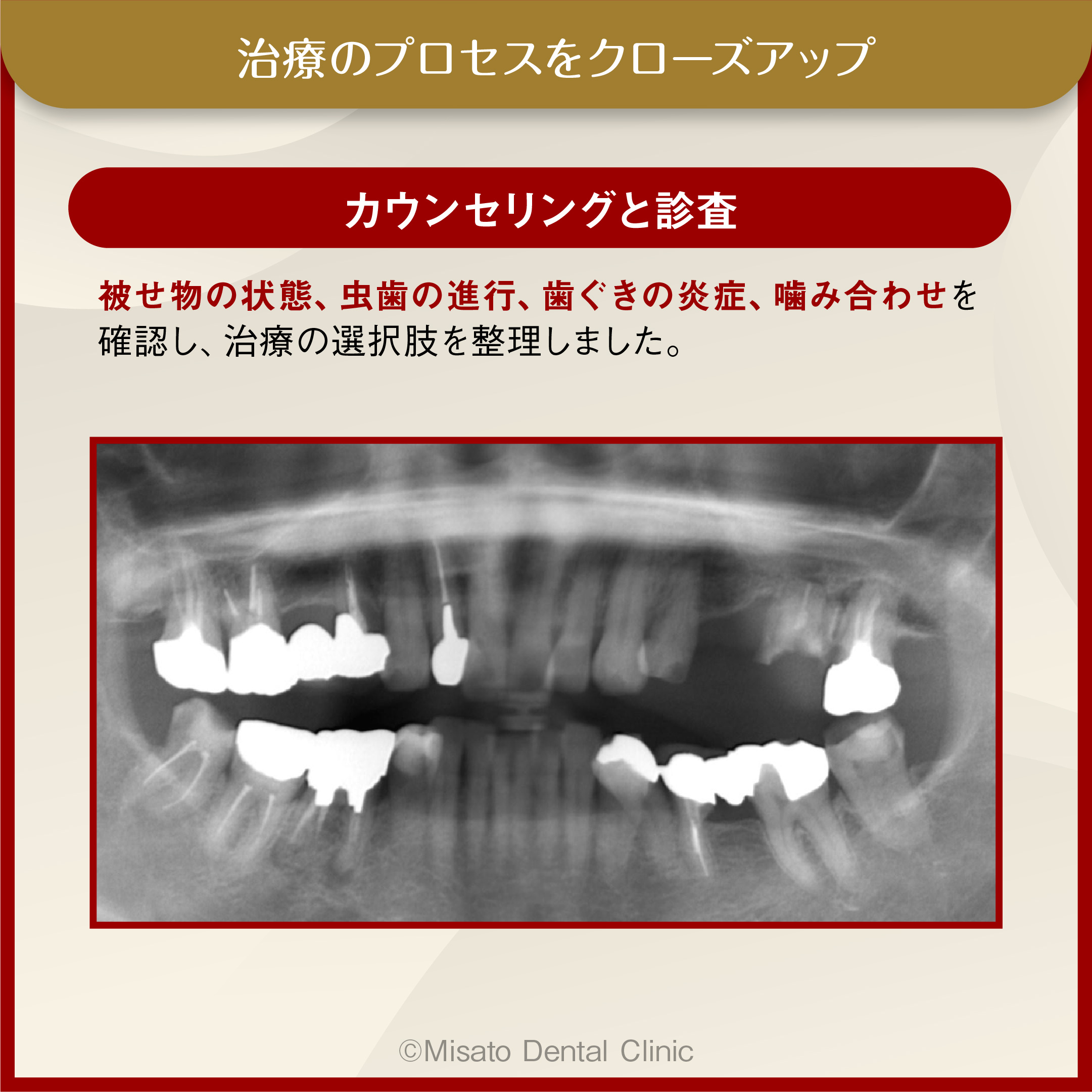 カウンセリングと診査