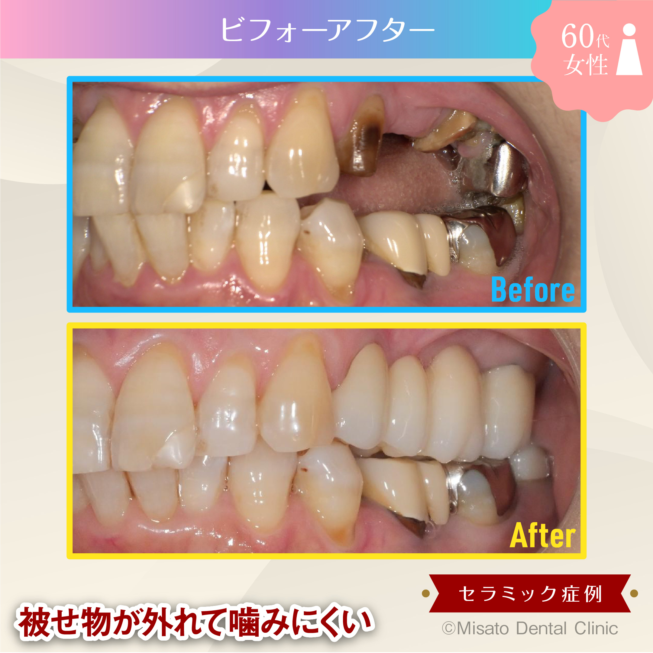 ビフォーアフター