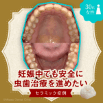妊娠中でも安全に虫歯治療を進めたい
