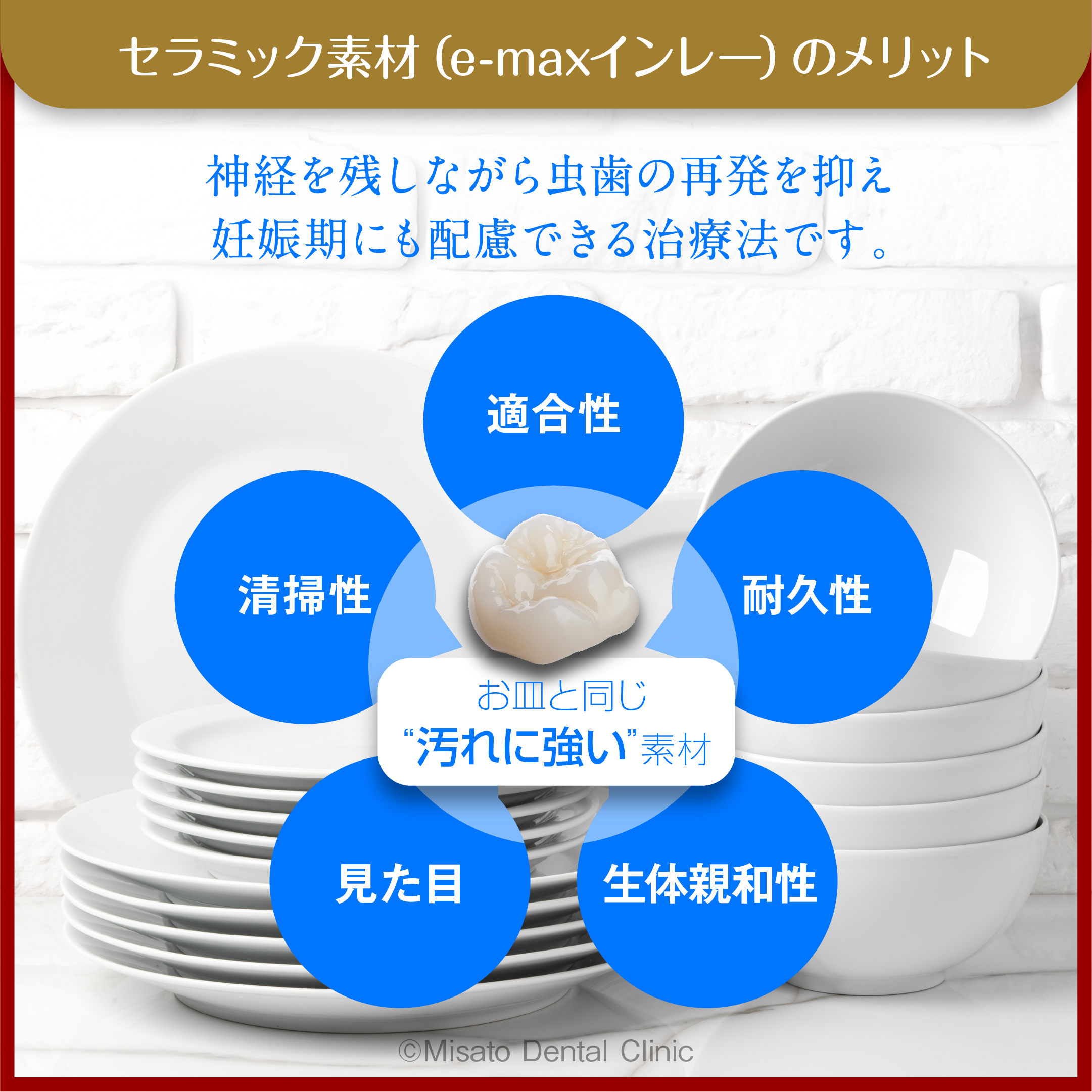 セラミック素材のメリット