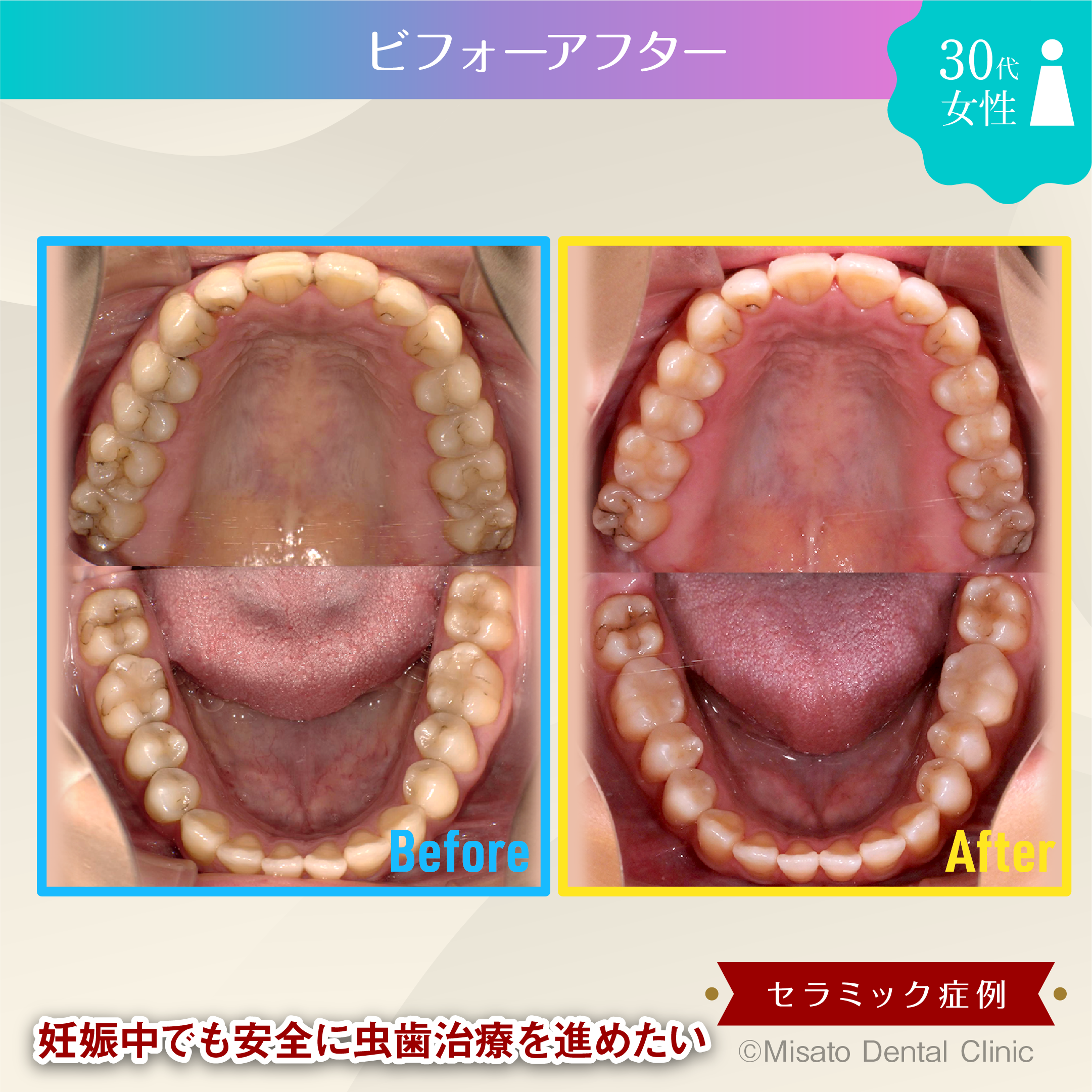 ビフォーアフター